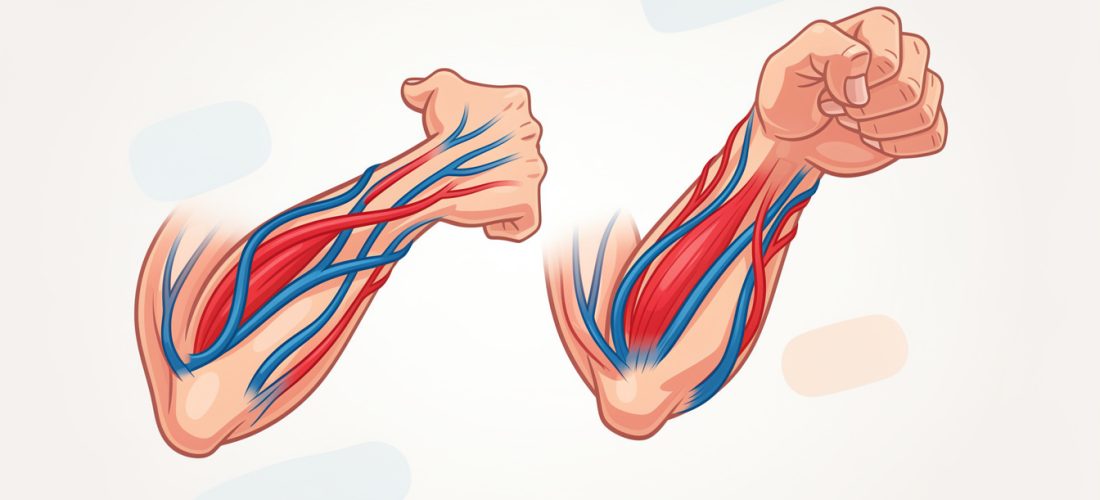 découvrez pourquoi les veines de vos bras peuvent se voir plus nettement, les causes possibles et quand consulter un professionnel de santé.